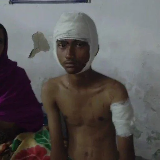 Jamshedpur Teen Attacked After Social Media Photo Alteration