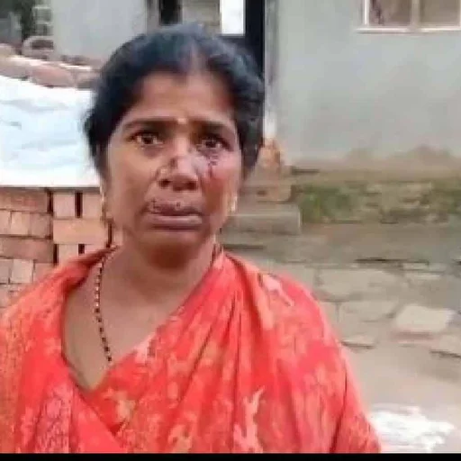 Telangana Woman Injured in Early Morning Jackal Attack, Villagers Kill Animal