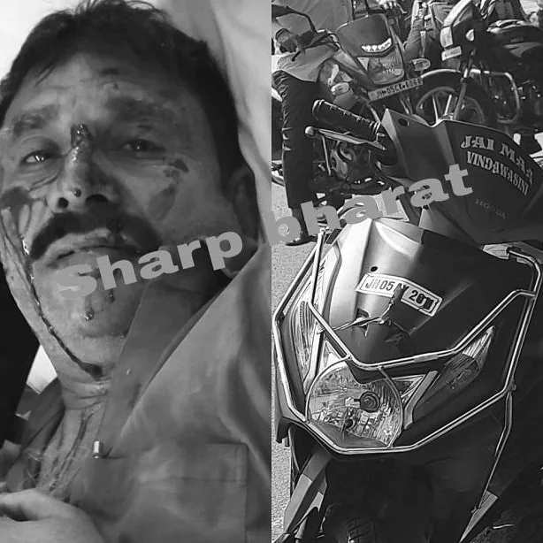 Jamshedpur Scooter Accident: Bus Conductor Injured After Hitting Divider