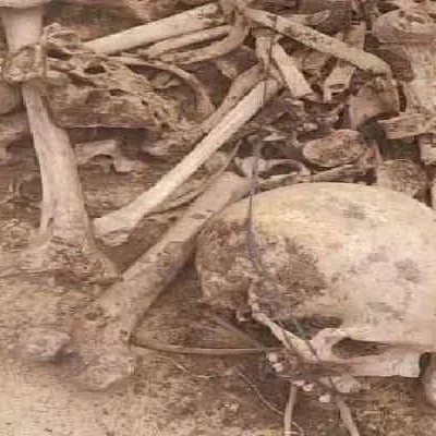 Just In: Human Skull Found in Sack at Jharkhand Dam Sparks Investigation
