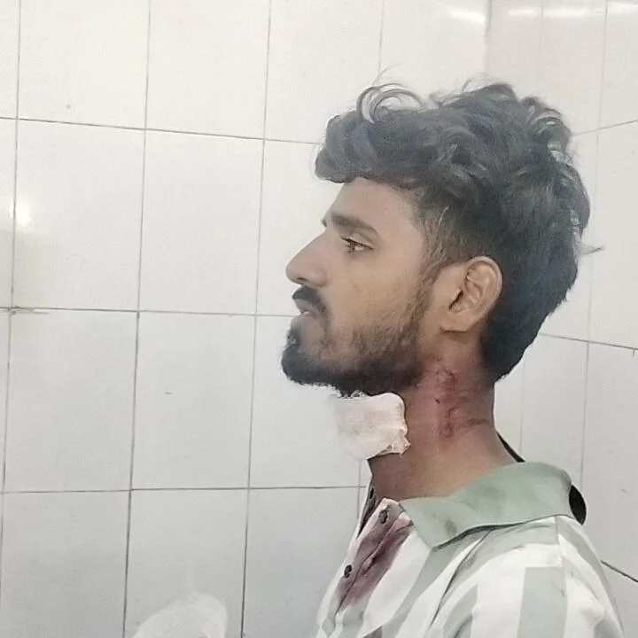 Just In: Jamshedpur Chaumin Vendor Attacked for Refusing Extortion